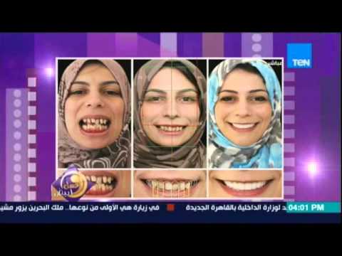 بالفيديو أحدث صيحة لتجميل الأسنان