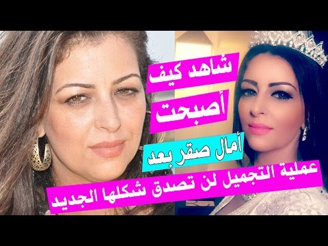 تغيير أمال صقر بشكل لا يصدق