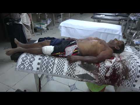 شاهد استشهاد مواطن وإصابة أخر بقصف مدفعي للمليشيات الحوثية